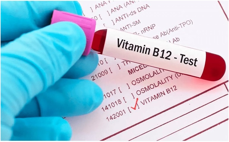 What Should You Know About Vitamin B12 Deficiency