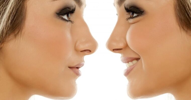 6 Reasons You Should Have a Rhinoplasty