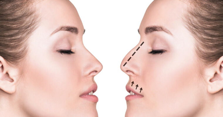 Why should you prefer to go for Nose surgery?